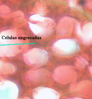 Col�nquima
