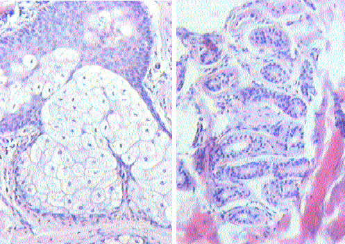 Glándula exocrina