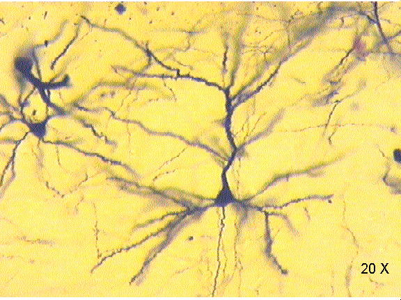 Neurona multipolar