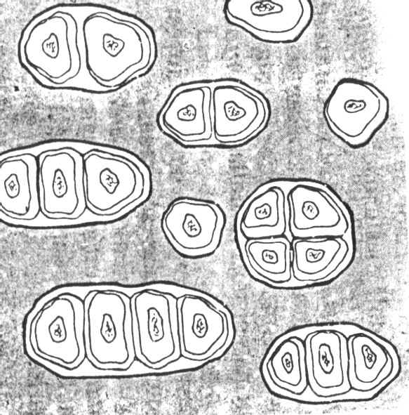 Esquema de tejido cartilaginoso