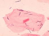 Bacterias 'Lactobacillus' (procariotas) sobre cél. epitelial (eucariota) Bacterias 'Lactobacillus' (procariotas) sobre cél. epitelial (eucariota)