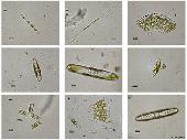 Diversas Diatomeas de una fuente (F: Wikipedia)