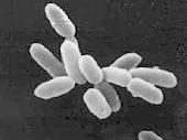 Arqueobacteria halófila (Fuente: Wikipedia) Arqueobacteria halófila (Fuente: Wikipedia)