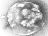 Arqueobacteria siendo infectada por virus (F: Wikipedia) Arqueobacteria siendo infectada por virus (F: Wikipedia)