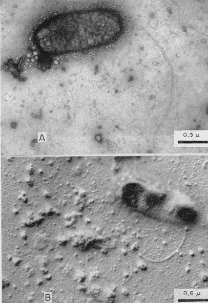 imagen microscopio electrónico