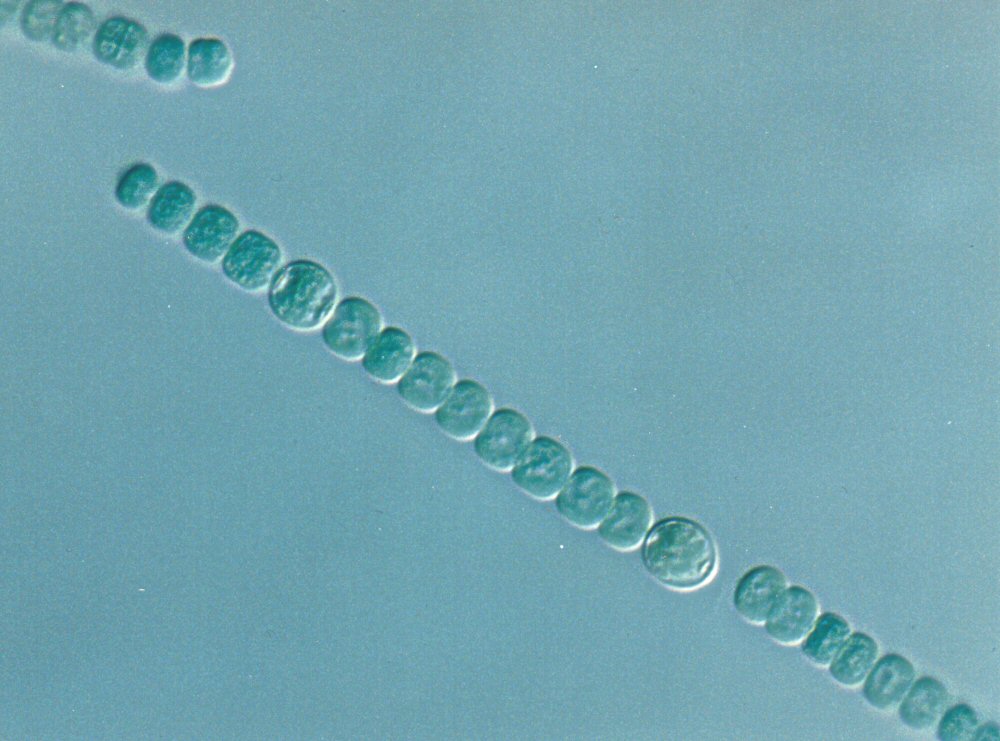cianobacteria