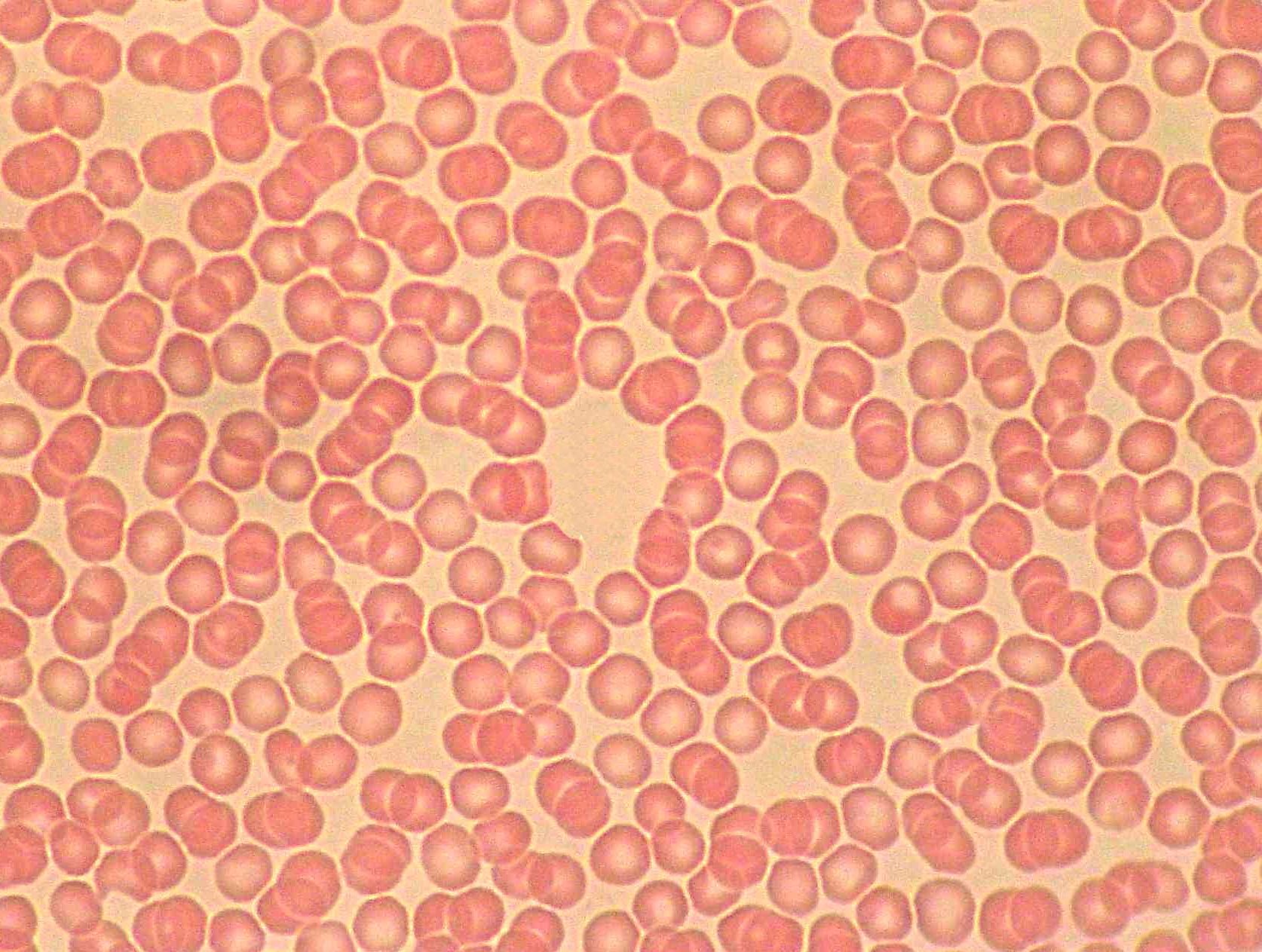 eritrocitos