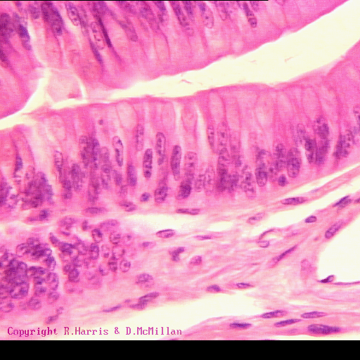 epitelio pseudoestratificado