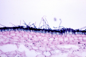 pelos absorbentes Los pelos absorbentes son expansiones de las células de la epidermis
